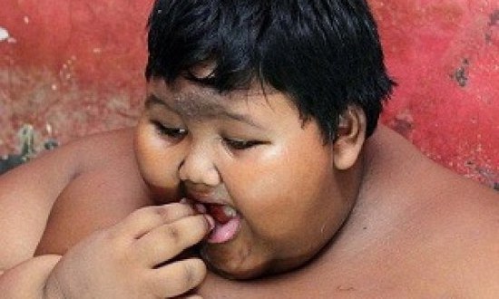 Το δράμα που ζει το πιο υπέρβαρο παιδί στον κόσμο (photos)!