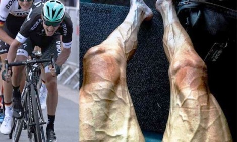 Έτσι έγιναν τα πόδια ενός ποδηλάτη μετά από 16 γύρους στο Tour de France