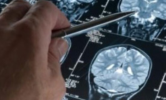 Έφτιαξαν εγκεφαλικά κύτταρα με Αλτσχάιμερ –Ανοίγει ο δρόμος για την θεραπεία της νόσου
